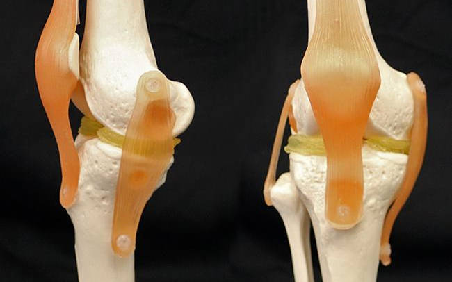 possible-3d-printed-knee-cartilage-repair