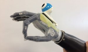 U of Newcastle bionic hand with vision