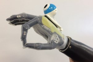 U of Newcastle bionic hand with vision