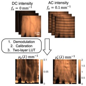 BostonU SPIE camera reveals postprandial lipid levels