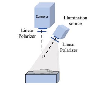 BostonU SPIE camera reveals postprandial lipid levels