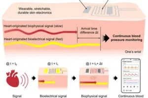 SeoulNatU cuffless blood pressure monitor web