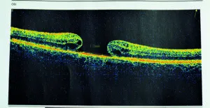 Real-time data and the role of AI